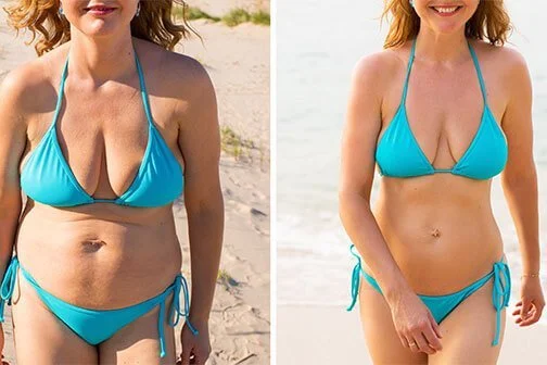 Weight-management transformation