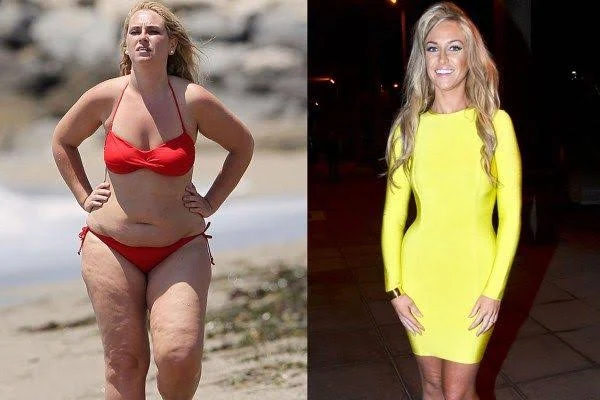 Weight-management transformation